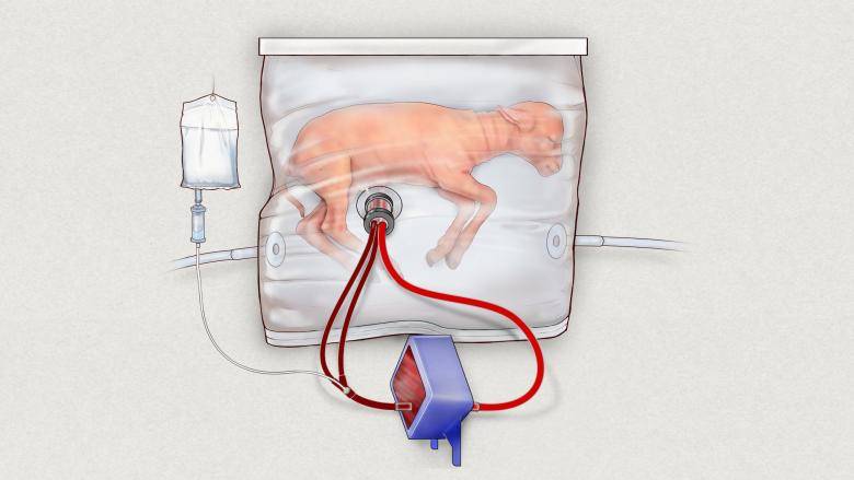 Watch: Scientists develop artificial womb to help premature babies