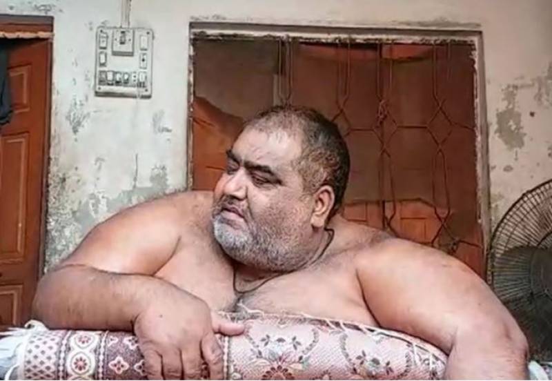 Obese Sadiqabad man Noor ul Hassan dies at Lahore's Shalamar hospital